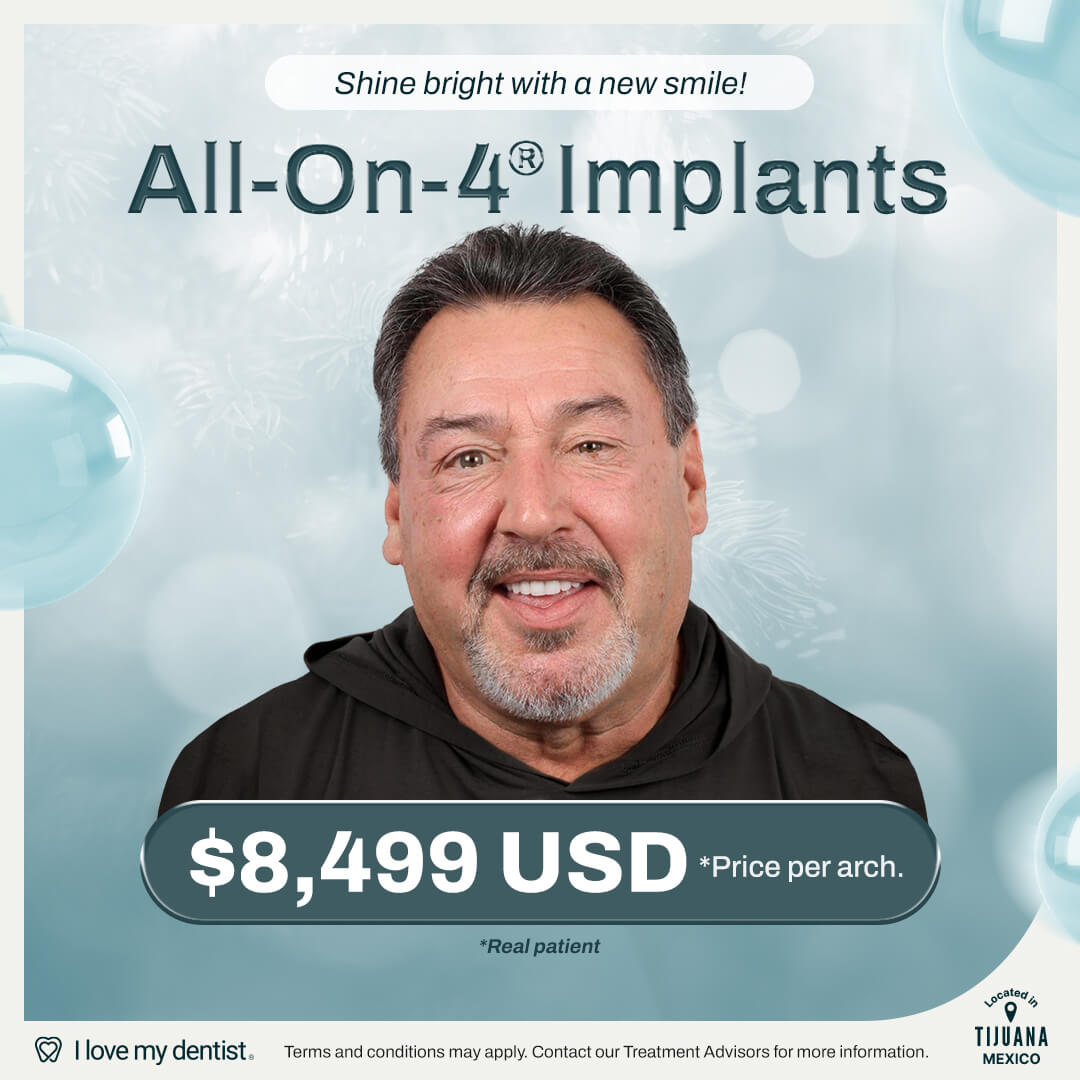 All on 4 dental implants in Tijuana