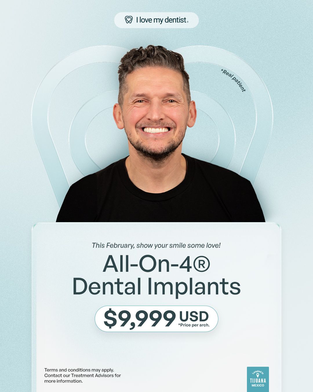 All on 4 dental implants in Tijuana