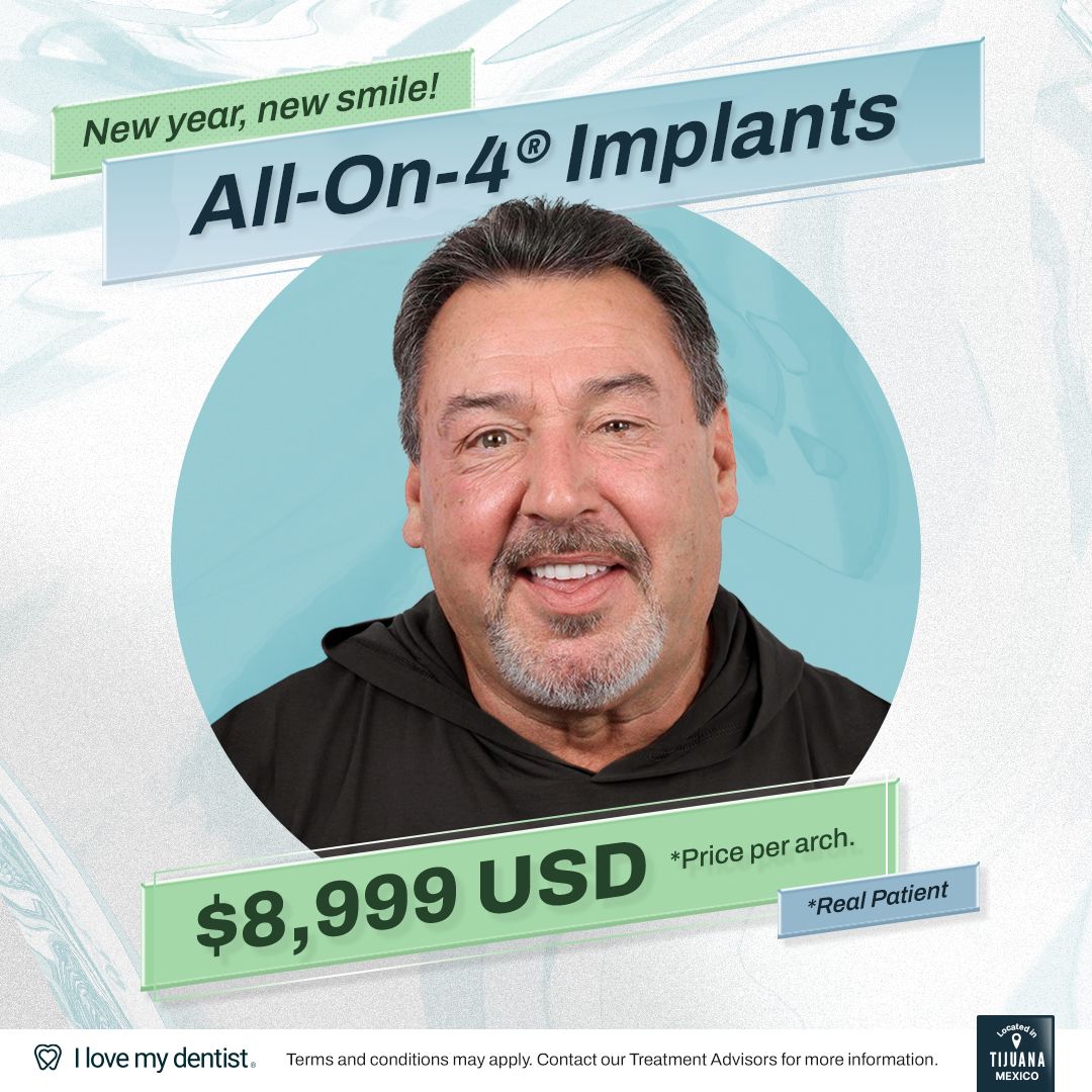 All on 4 dental implants in Tijuana