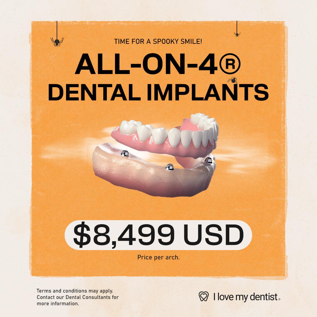 All on 4 dental implants in Tijuana