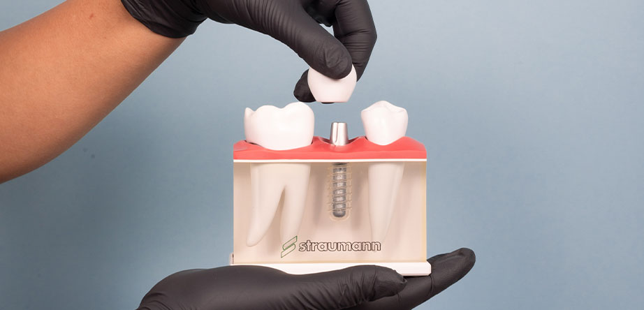 dental implant cost tijuana dentist