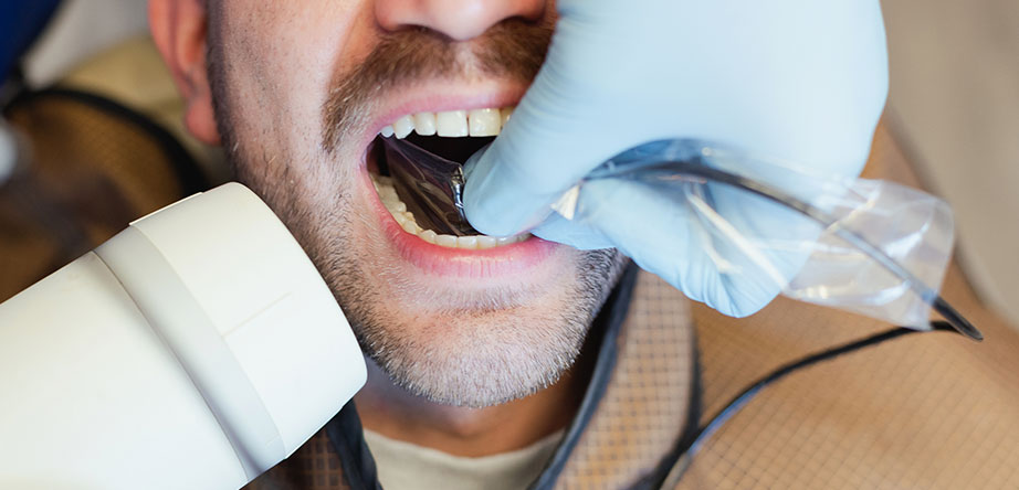 dental treatments in tijuana