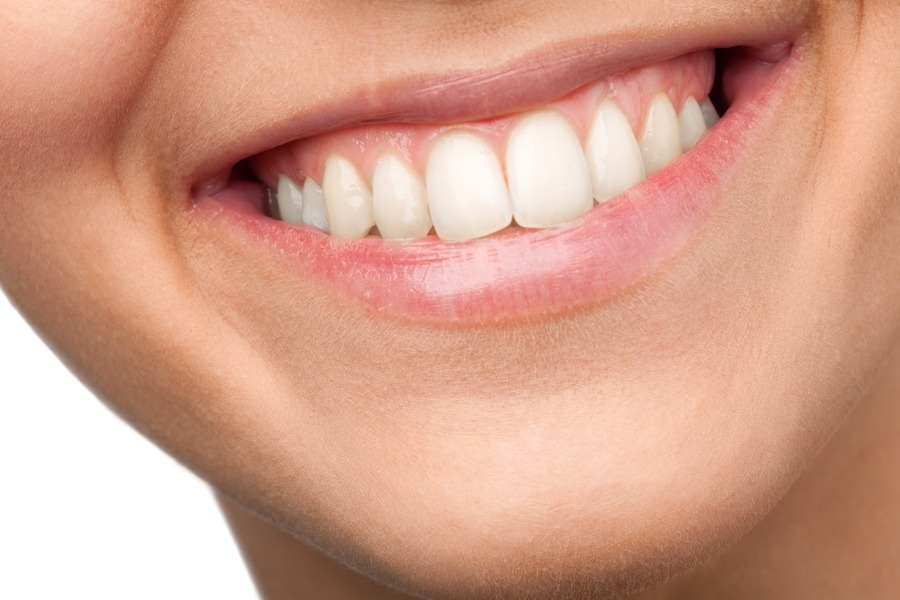 Full Mouth Reconstruction with dental implants in Tijuana