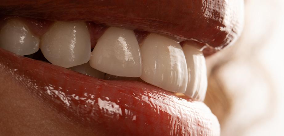 Beyond the Mirror: Exploring Aesthetic Dentistry's Modern Marvels