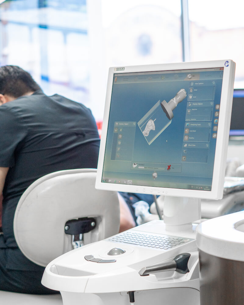 How Same-Day Crowns in Tijuana Transform Emergency Dental Care