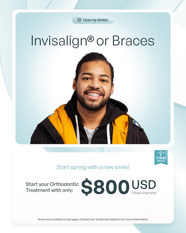 Orthodontics, braces in Tijuana, Invisalign treatment