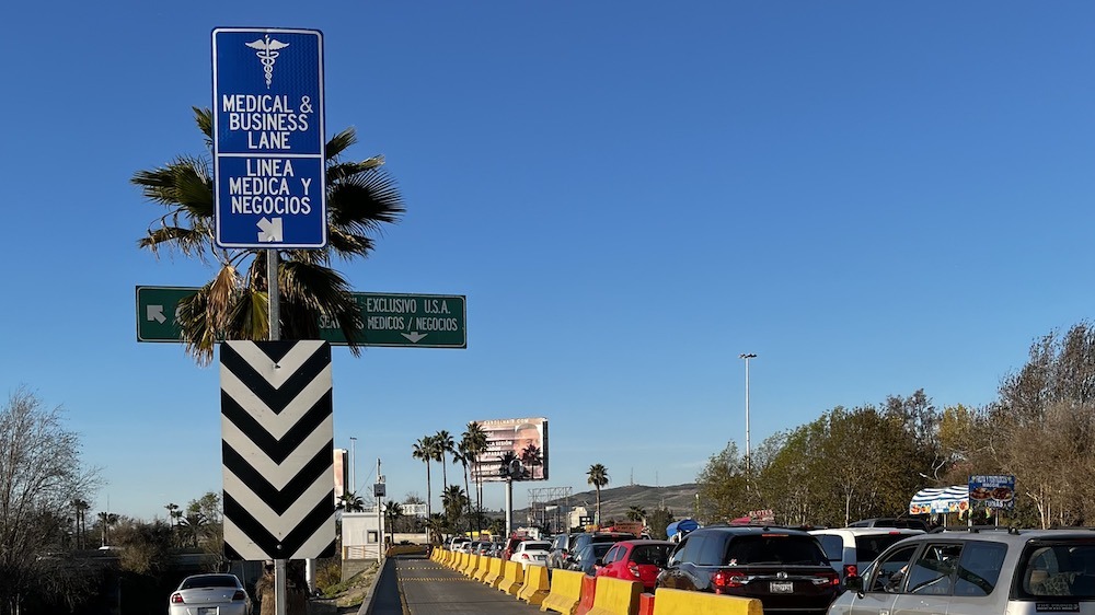 What you need to know when coming to the dentist in Tijuana in 2022