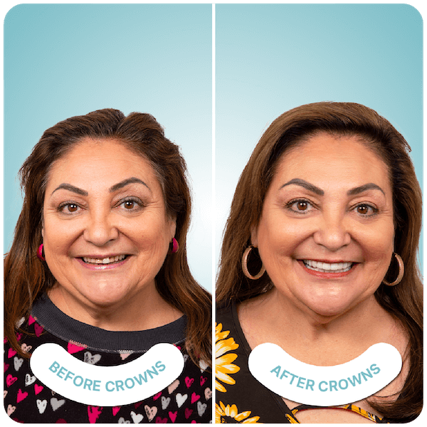 best crowns dentist in tijuana