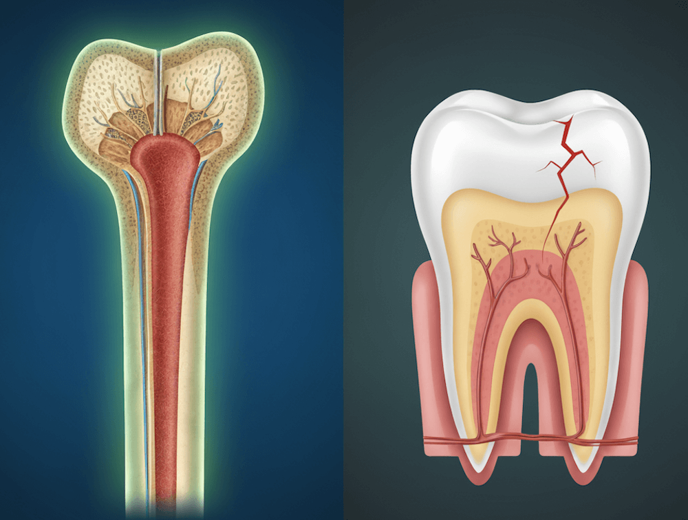 Are Teeth Bones