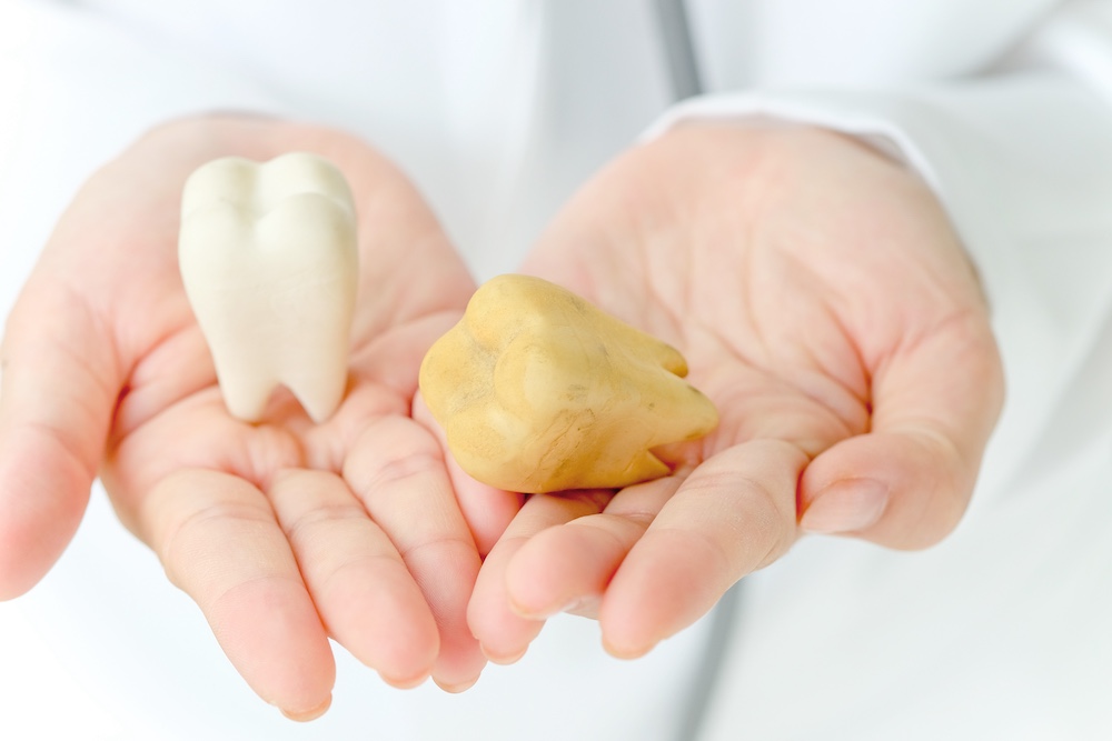 Dental Crowns Cost in Mexico