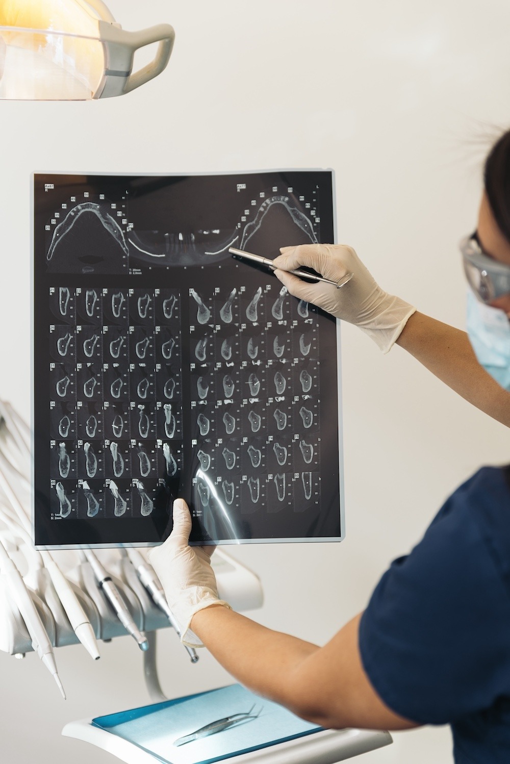 Tooth Number Chart: Understand Your Dental Map in Minutes